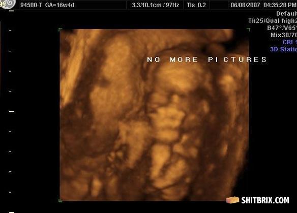 Nomorepics